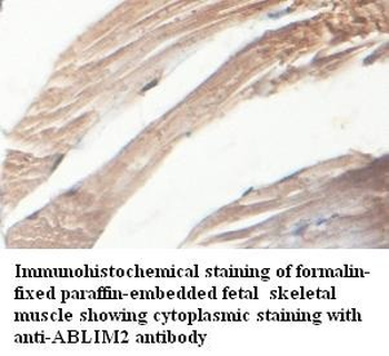 ABLIM2 Rabbit Polyclonal Antibody