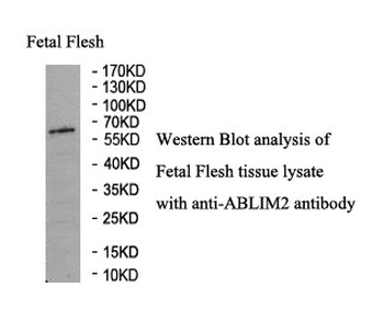 ABLIM2 Rabbit Polyclonal Antibody
