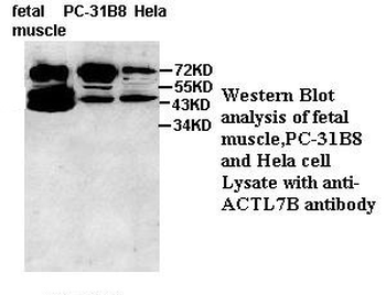 ACTL7B Rabbit Polyclonal Antibody