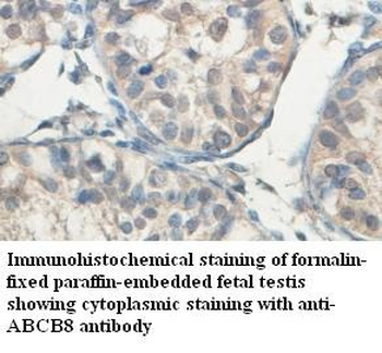 ABCB8 Rabbit Polyclonal Antibody