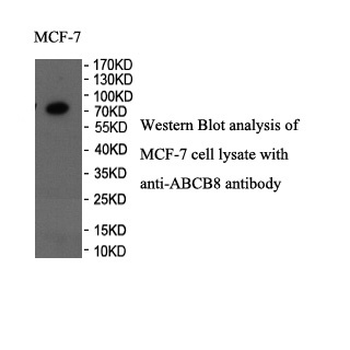 ABCB8 Rabbit Polyclonal Antibody