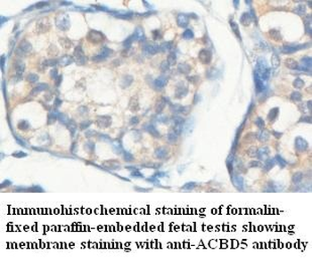 ACBD5 Rabbit Polyclonal Antibody
