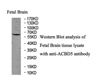 ACBD5 Rabbit Polyclonal Antibody
