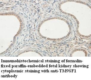 TM9SF1 Rabbit Polyclonal Antibody