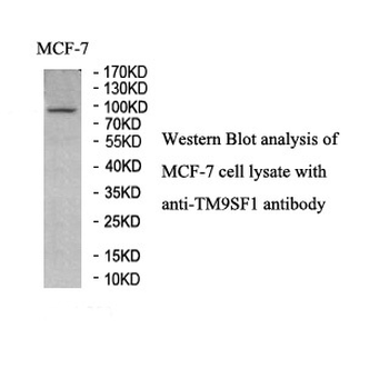 TM9SF1 Rabbit Polyclonal Antibody