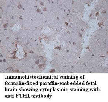 FTH1 Rabbit Polyclonal Antibody