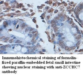 ZCCHC7 Rabbit Polyclonal Antibody