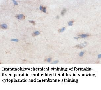 PIP5K2-beta Rabbit Polyclonal Antibody