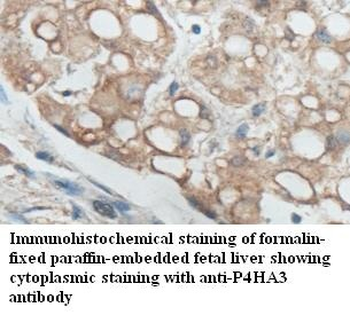 P4HA3 Rabbit Polyclonal Antibody