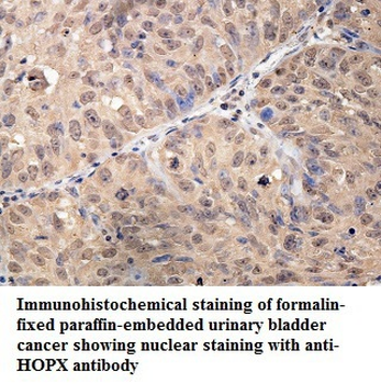 HOPX Rabbit Polyclonal Antibody
