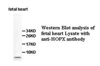 HOPX Rabbit Polyclonal Antibody