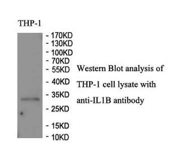 IL1B Rabbit Polyclonal Antibody