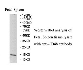 CD48 Rabbit Polyclonal Antibody