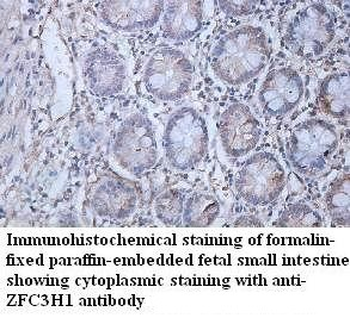 ZFC3H1 Rabbit Polyclonal Antibody