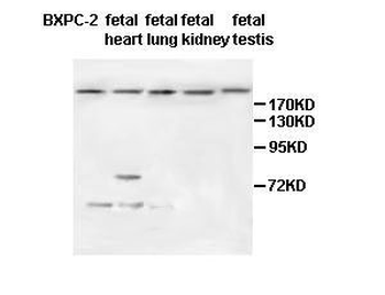 ZFC3H1 Rabbit Polyclonal Antibody