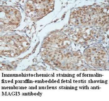MAGI3 Rabbit Polyclonal Antibody