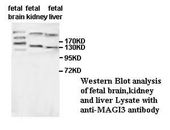 MAGI3 Rabbit Polyclonal Antibody
