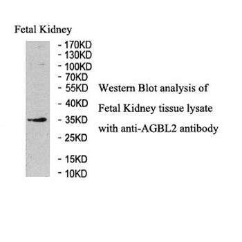 AGBL2 Rabbit Polyclonal Antibody