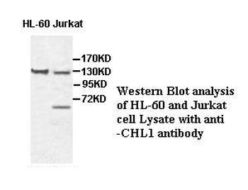 CHL1 Rabbit Polyclonal Antibody