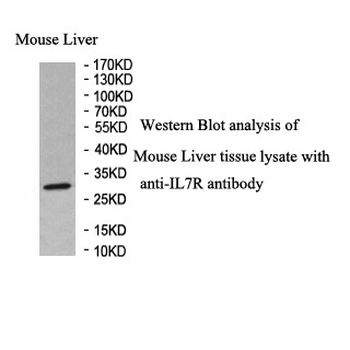 IL7R Rabbit Polyclonal Antibody