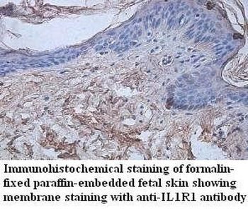 IL1R1 Rabbit Polyclonal Antibody