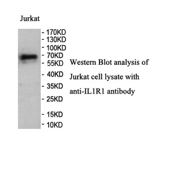 IL1R1 Rabbit Polyclonal Antibody