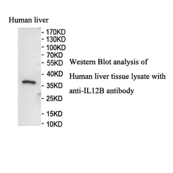 IL12B Rabbit Polyclonal Antibody