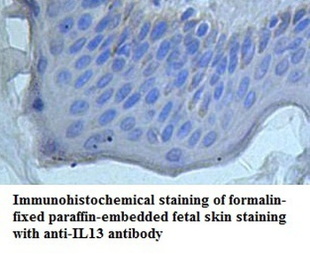 IL13 Rabbit Polyclonal Antibody