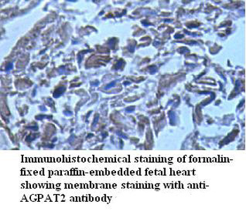 AGPAT2 Rabbit Polyclonal Antibody