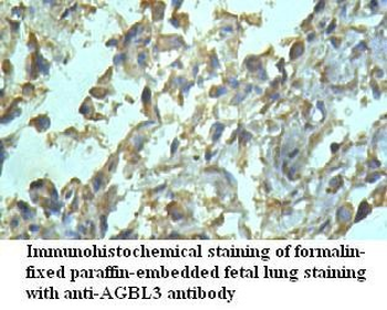 AGBL3 Rabbit Polyclonal Antibody