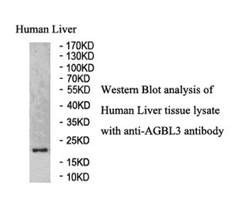 AGBL3 Rabbit Polyclonal Antibody