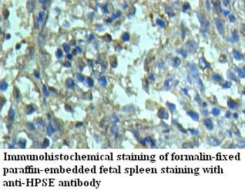 HPSE Rabbit Polyclonal Antibody