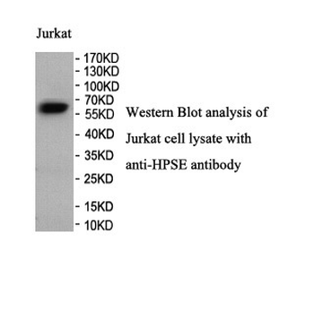 HPSE Rabbit Polyclonal Antibody