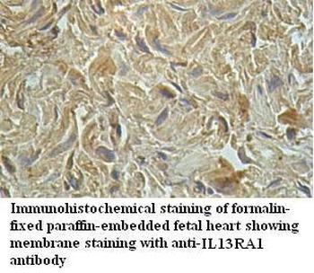 IL13RA1 Rabbit Polyclonal Antibody