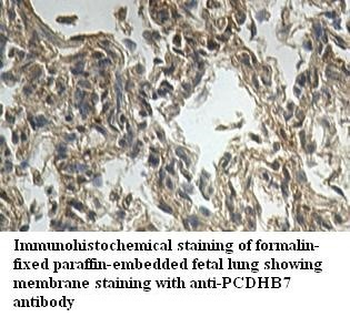 PCDHB7 Rabbit Polyclonal Antibody