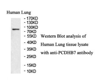 PCDHB7 Rabbit Polyclonal Antibody