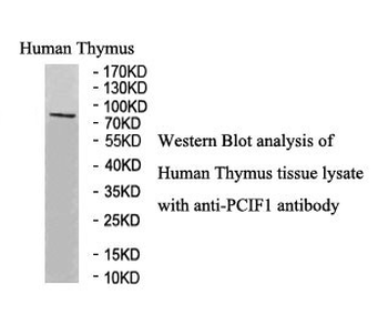 PCIF1 Rabbit Polyclonal Antibody