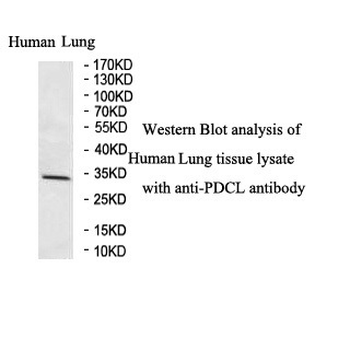 PDCL Rabbit Polyclonal Antibody