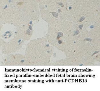 PCDHB16 Rabbit Polyclonal Antibody