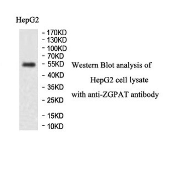 ZGPAT Rabbit Polyclonal Antibody