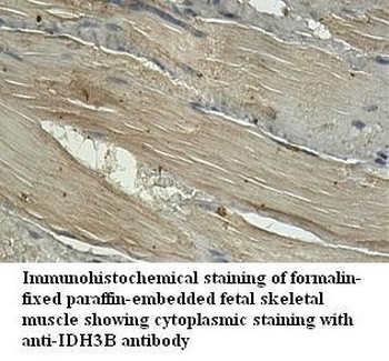 IDH3B Rabbit Polyclonal Antibody