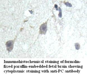 PC Rabbit Polyclonal Antibody