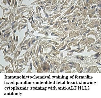 ALDH1L2 Rabbit Polyclonal Antibody