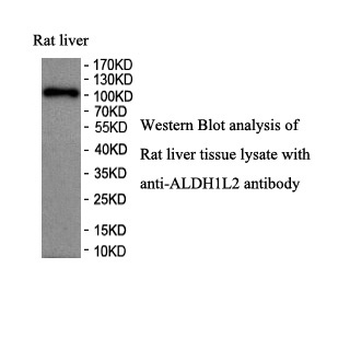 ALDH1L2 Rabbit Polyclonal Antibody