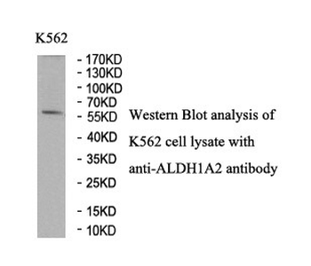 ALDH1A2 Rabbit Polyclonal Antibody