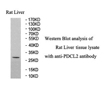 PDCL2 Rabbit Polyclonal Antibody