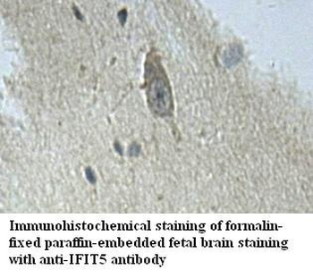 IFIT5 Rabbit Polyclonal Antibody