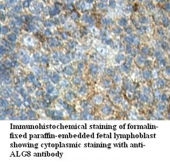 ALG8 Rabbit Polyclonal Antibody