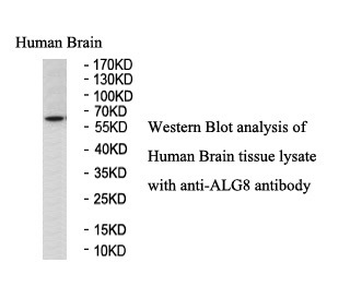 ALG8 Rabbit Polyclonal Antibody