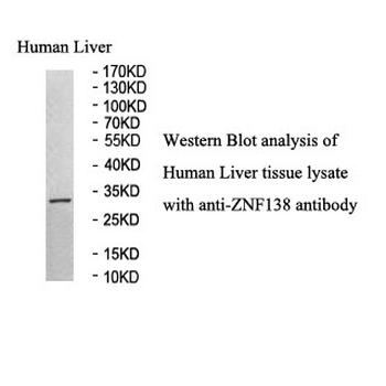 ZNF138 Rabbit Polyclonal Antibody